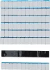 BGS technic Keréksúly 12x5 g, 50 db (BGS 8426)